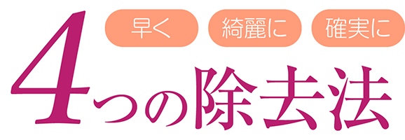 4つの除去法